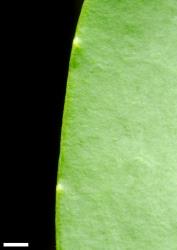 Veronica stricta var. stricta. Leaf margins showing minute hydathode teeth. Scale = 1 mm.
 Image: P.J. Garnock-Jones © P.J. Garnock-Jones CC-BY-NC 3.0 NZ